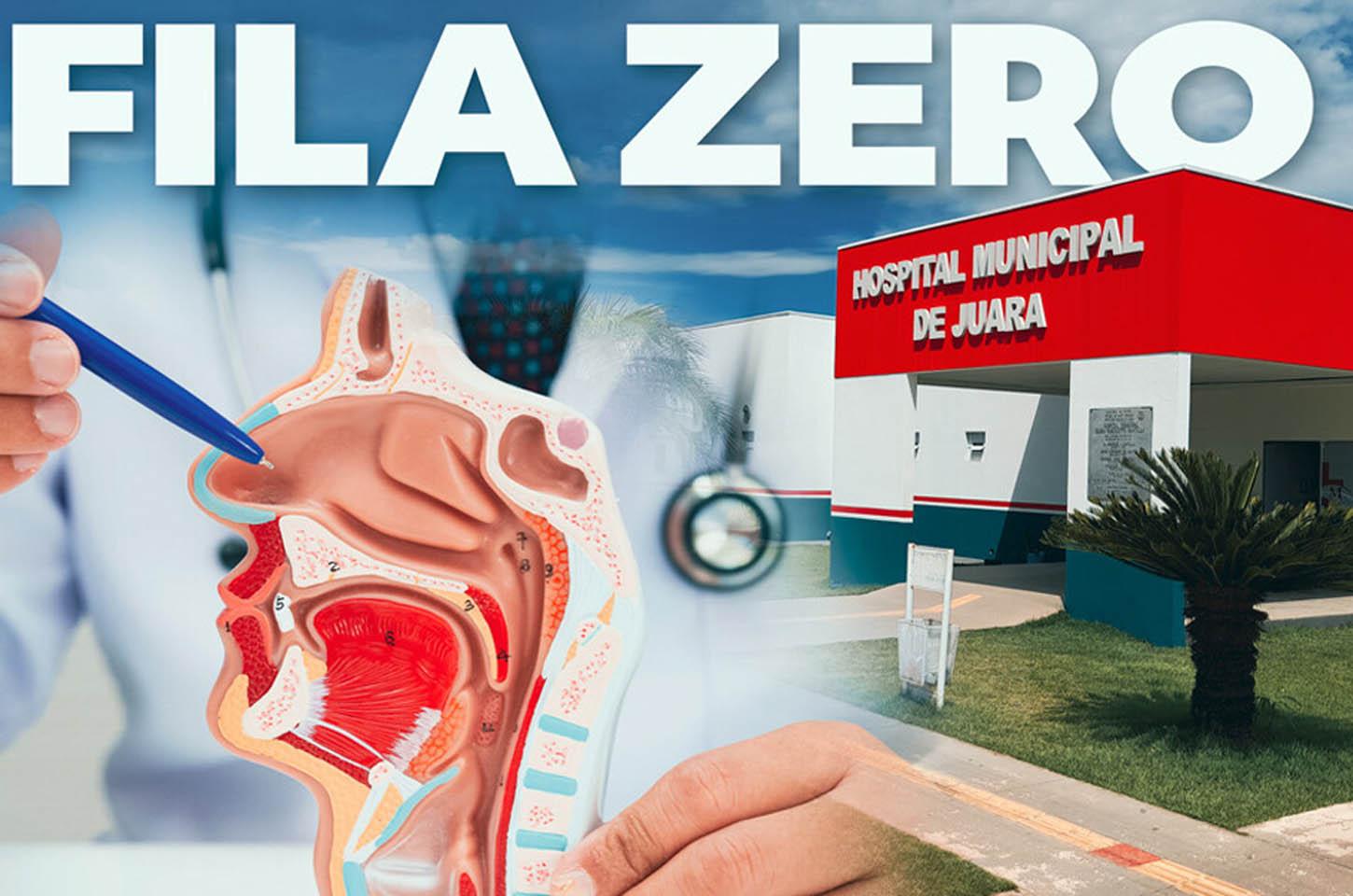 Fila Zero realiza 13 cirurgias de otorrinolaringologia em mutirão de fim de semana em Juara
